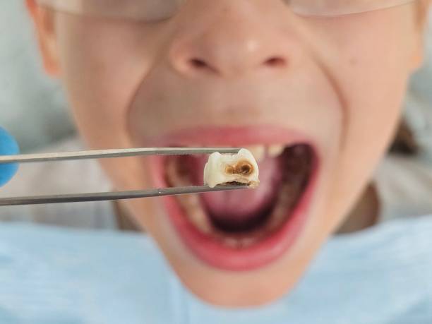 Best Emergency Gum Pain Relief  in East Chicago, IN